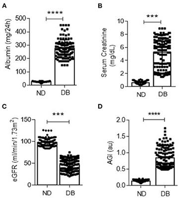 Advanced-Glycation End-Products Induce Podocyte Injury and Contribute to Proteinuria